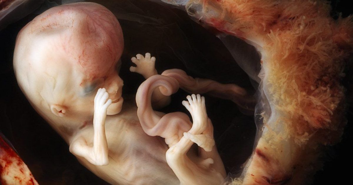 Newly-Opened Abortion Clinic Sets Weekly Quota For Number of Unborn Babies Killed | WLT Report