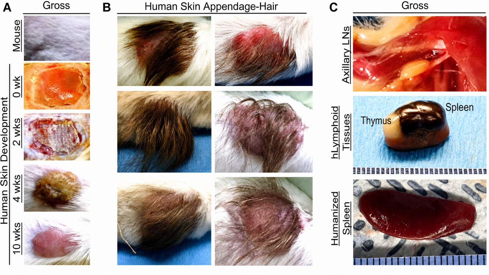 Scientific study images showing human fetal skin graft development and human hair growth on research mice